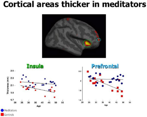 cortical areas meditators