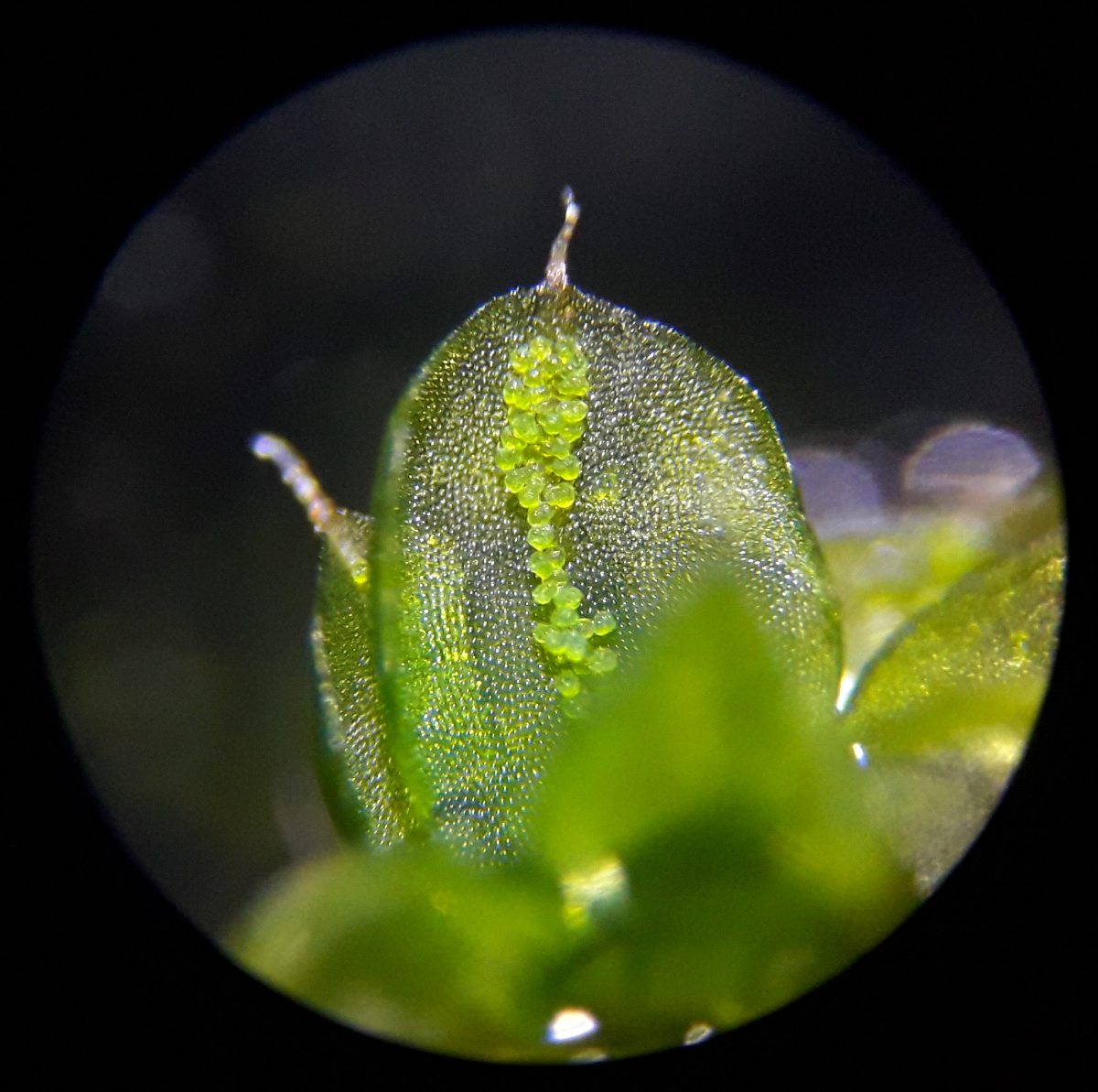 moss leaf under the microscope